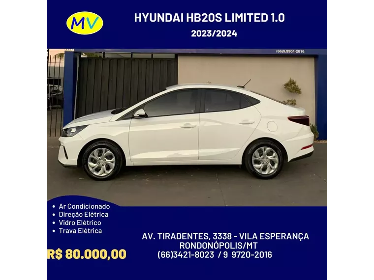 Hyundai HB20S Branco 1